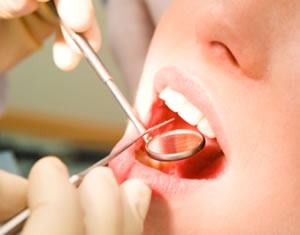 Peridontal Treatment Dysart Dental